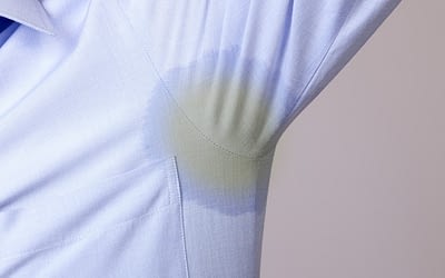 Say Bye to Yellow Stains with These Hacks